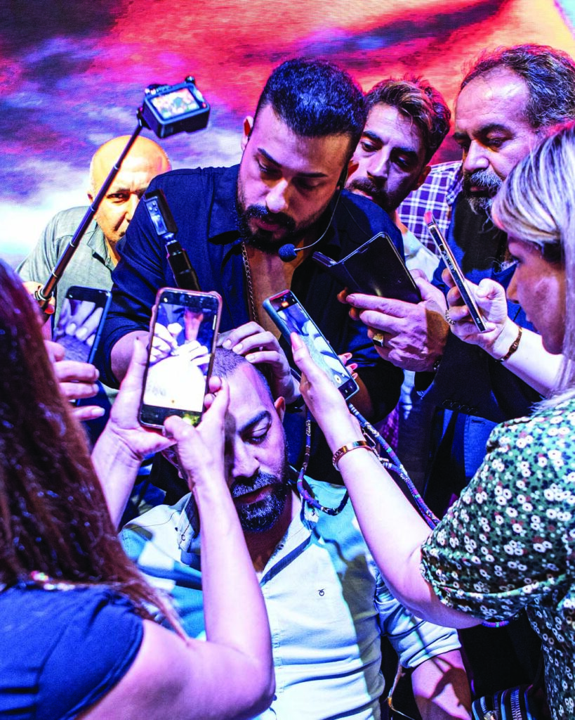 saç simülasyonu, saç dövmesi, saç gölgelendirme, smp, saç simülasyonu öncesi sonrası, saç simülasyonu yaptıranlar